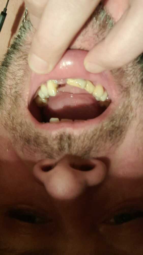 Проблемы с зубами 