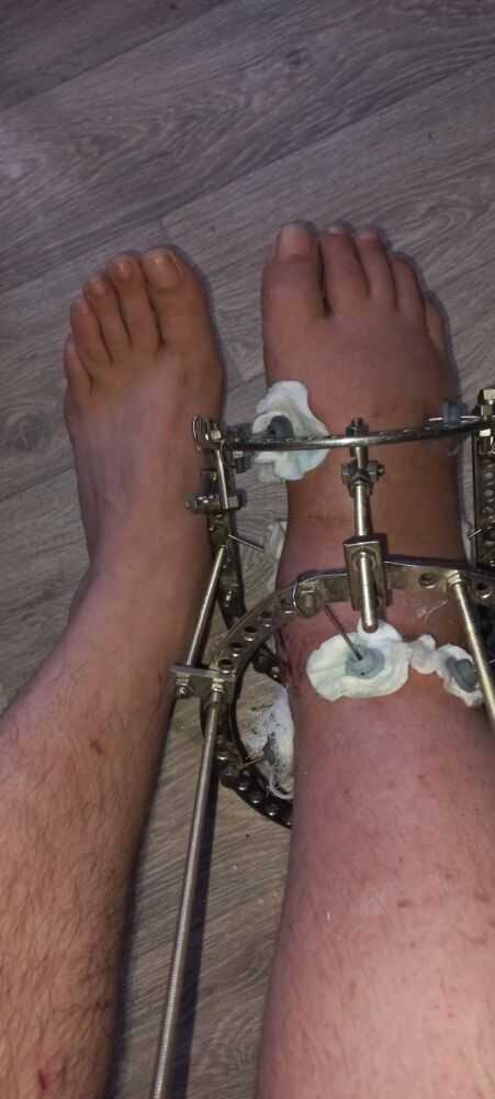 Нога в настоящие время