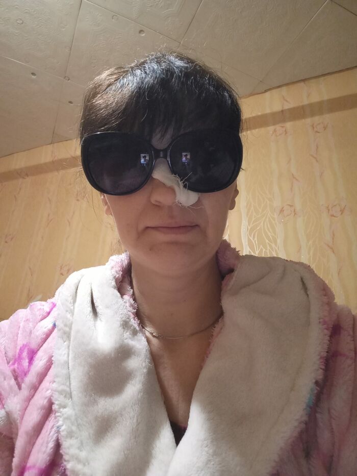 Так развивается моя болезнь